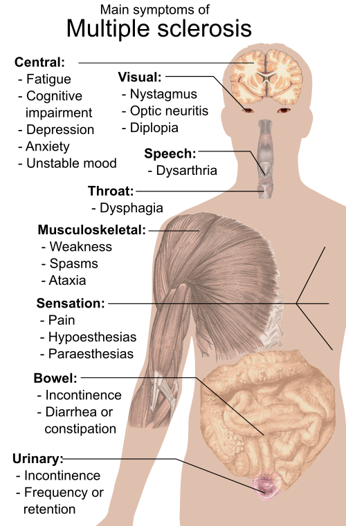 Symptoms_of_multiple_sclerosis.svg.png