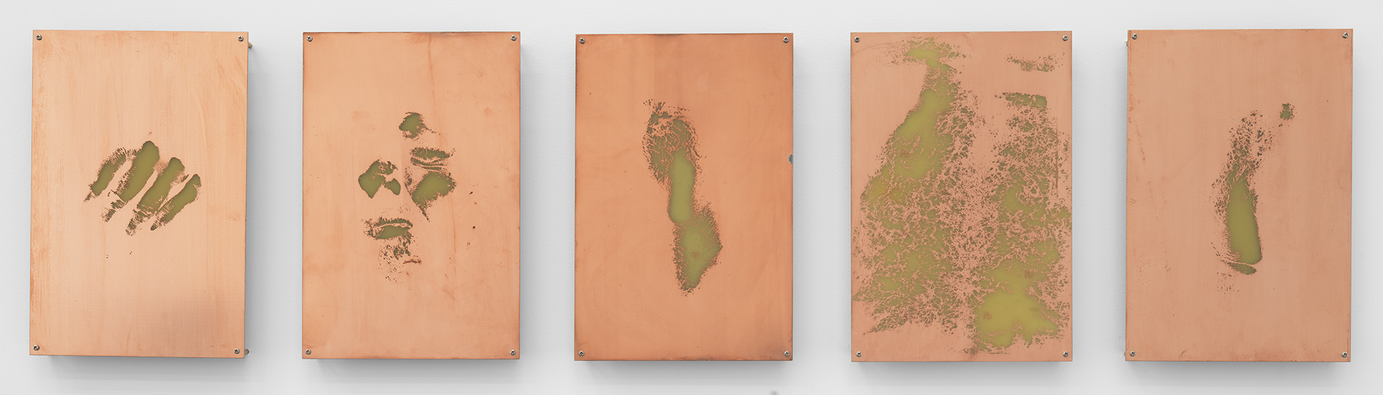   Body Print (Right Metacarpophalangeal Joint and Attending Soft Tissues, Right Zygomatic Bone and Attending Soft Tissues, Left Lateral Epicondyle, Abdomen, Right Lateral Epicondyle)    2017   Etched copper-clad FR-4 glass-reinforced epoxy laminate b