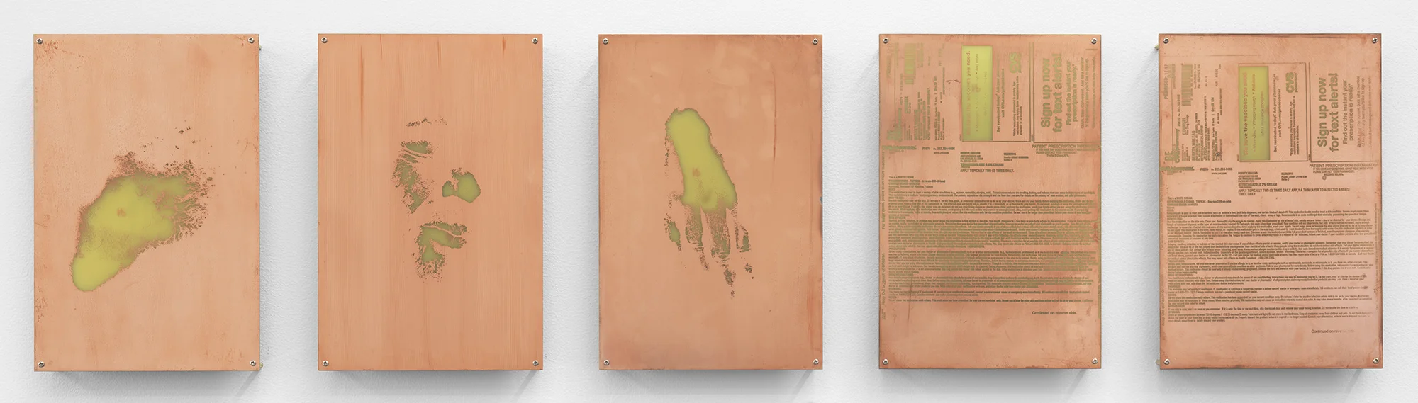 Body Print (Left Clavicle and Attending Soft Tissues, Left Zygomatic Bone and Attending Soft Tissues, Left Dorsum, Triamcinolone 0.5% Cream, Ketoconazole 2% Cream) 2017 Etched copper-clad FR-4 glass-reinforced epoxy laminate board 12 x 8 inches Open Source, 2017