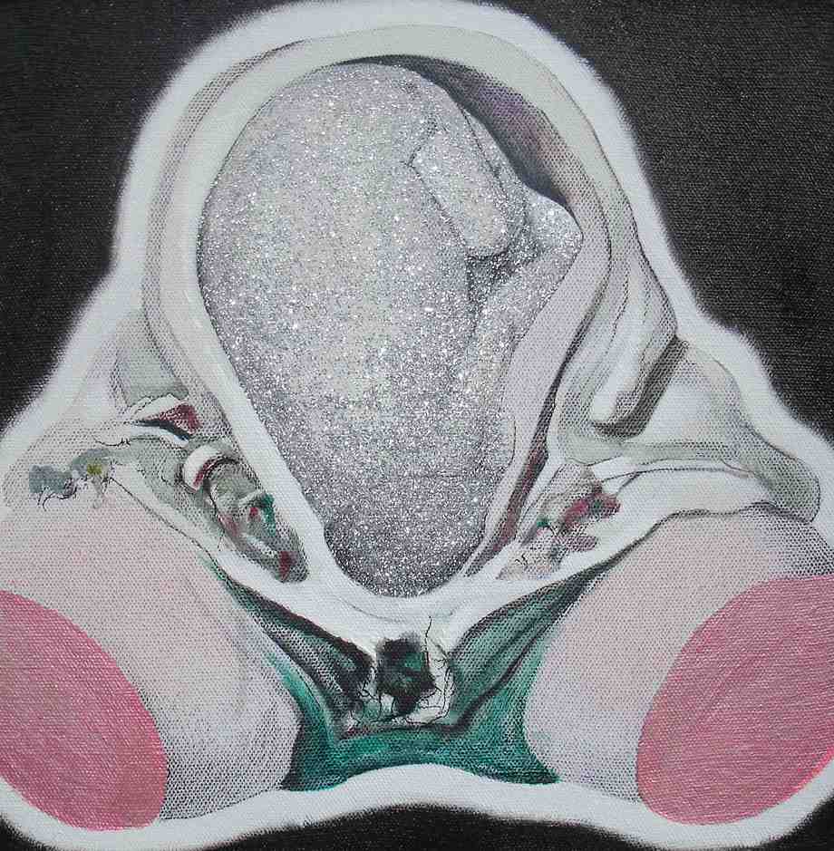 “Foetus 3” Acrylic on Canvas 40 x 40 cm 2009