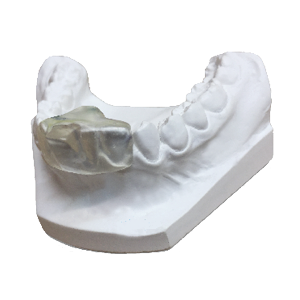 SCi + (Lab made appliance)- to get you started, treat a patient of your choice.
