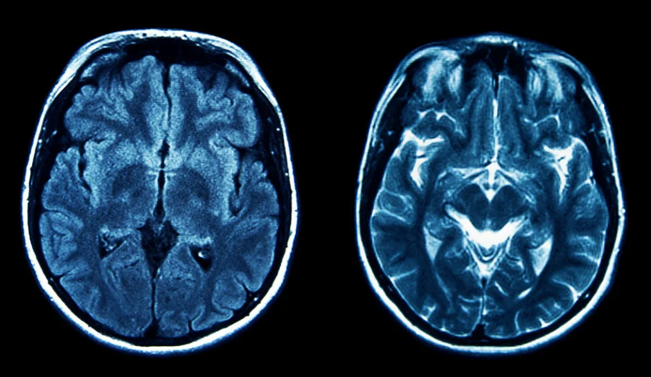 Brain-Scan.jpg