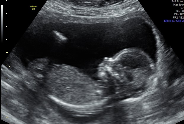 ultrasound.jpg