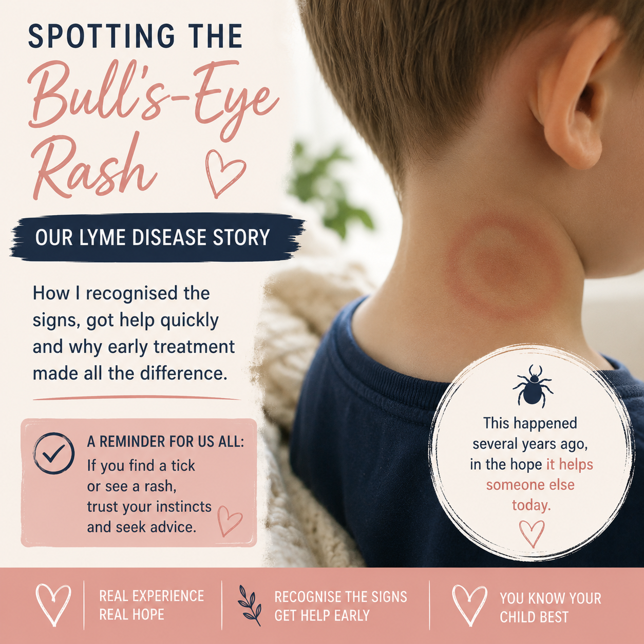 Child’s neck showing a bull’s-eye rash, an early sign of Lyme disease that prompted a same-day GP appointment.