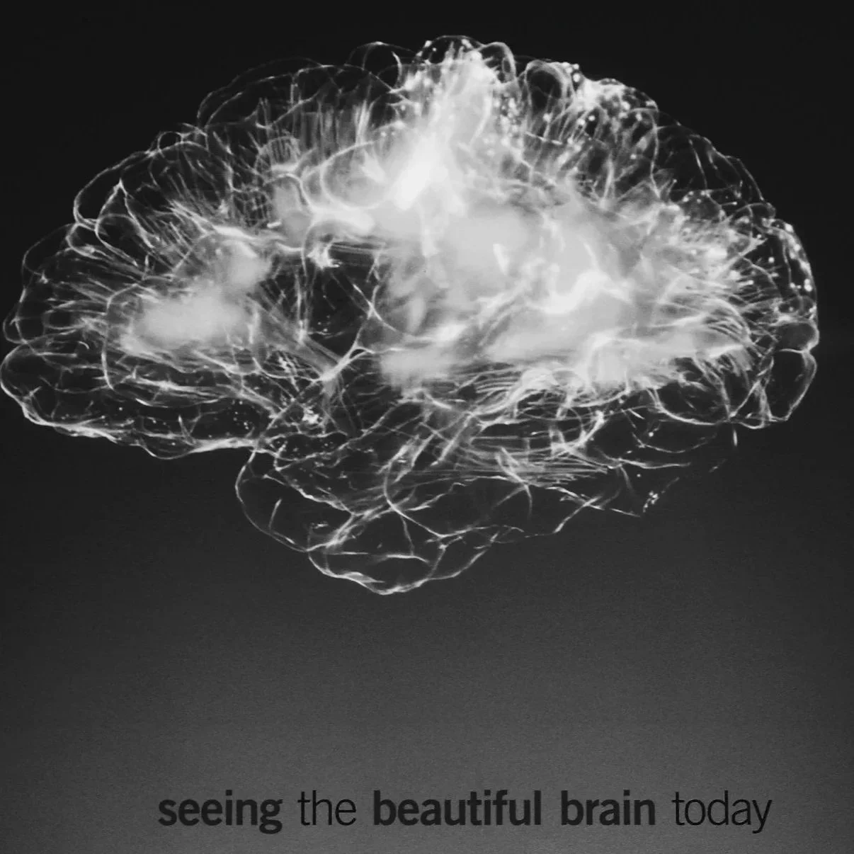 When Brain Fog Hits at the Doctor: Forgetting Symptoms During Medical Appointments