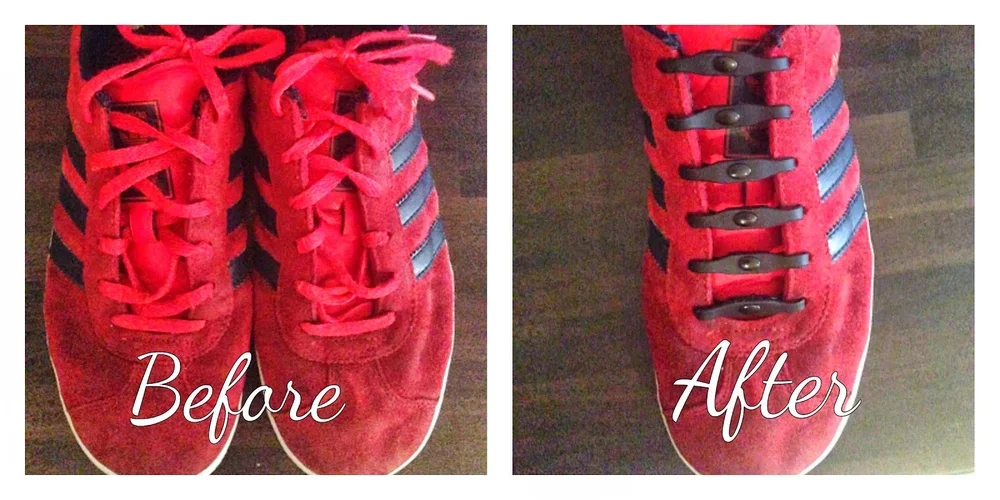 Review: SHOEPS Elastic Shoe Laces. Before and After photos