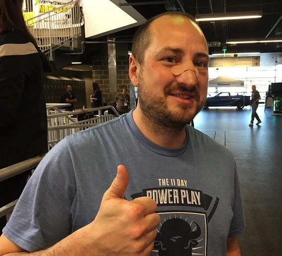 Nik Fattey is a Guiness World Record holder and broken nose haver. -Photo courtesy of WBFO