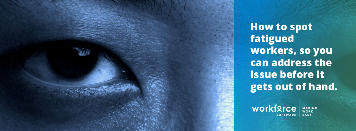 An Intimate Portrait of Your Exhausted Employee: 6 Signs the Job is Killing Them