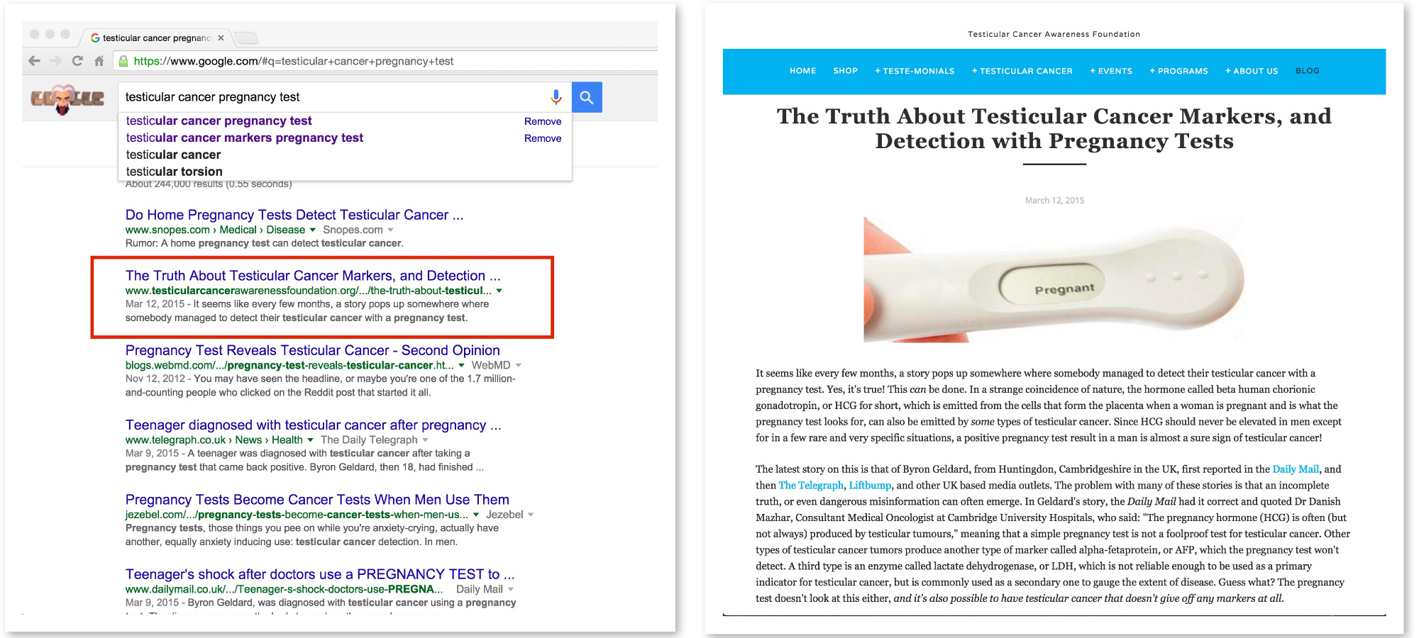 Do a Google search for "testicular cancer pregnancy test" and guess what you'll find? One of mine!
