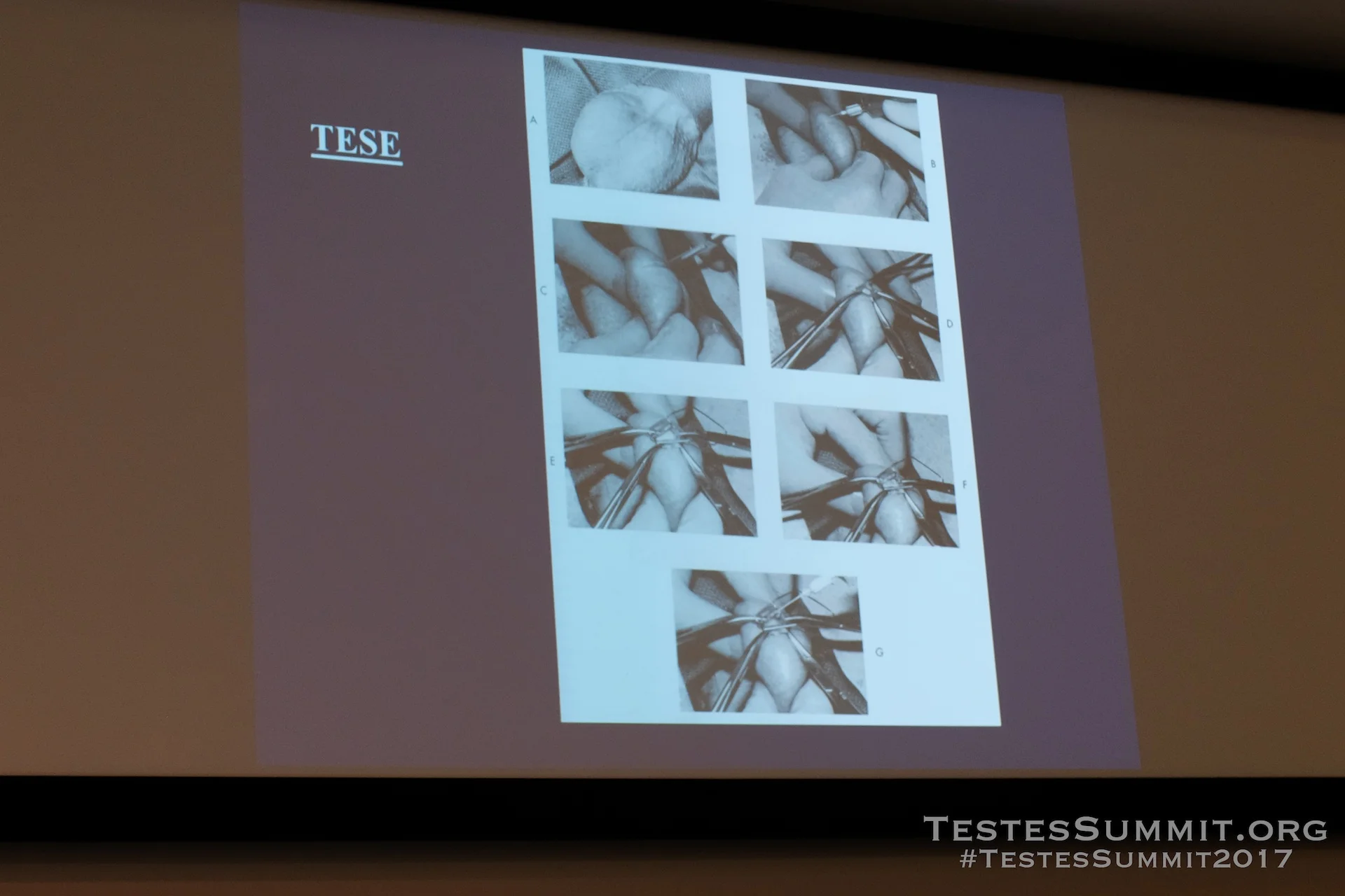 TestesSummit2017-NANGIA_043_DSCF5668ap-HD-WM.jpg