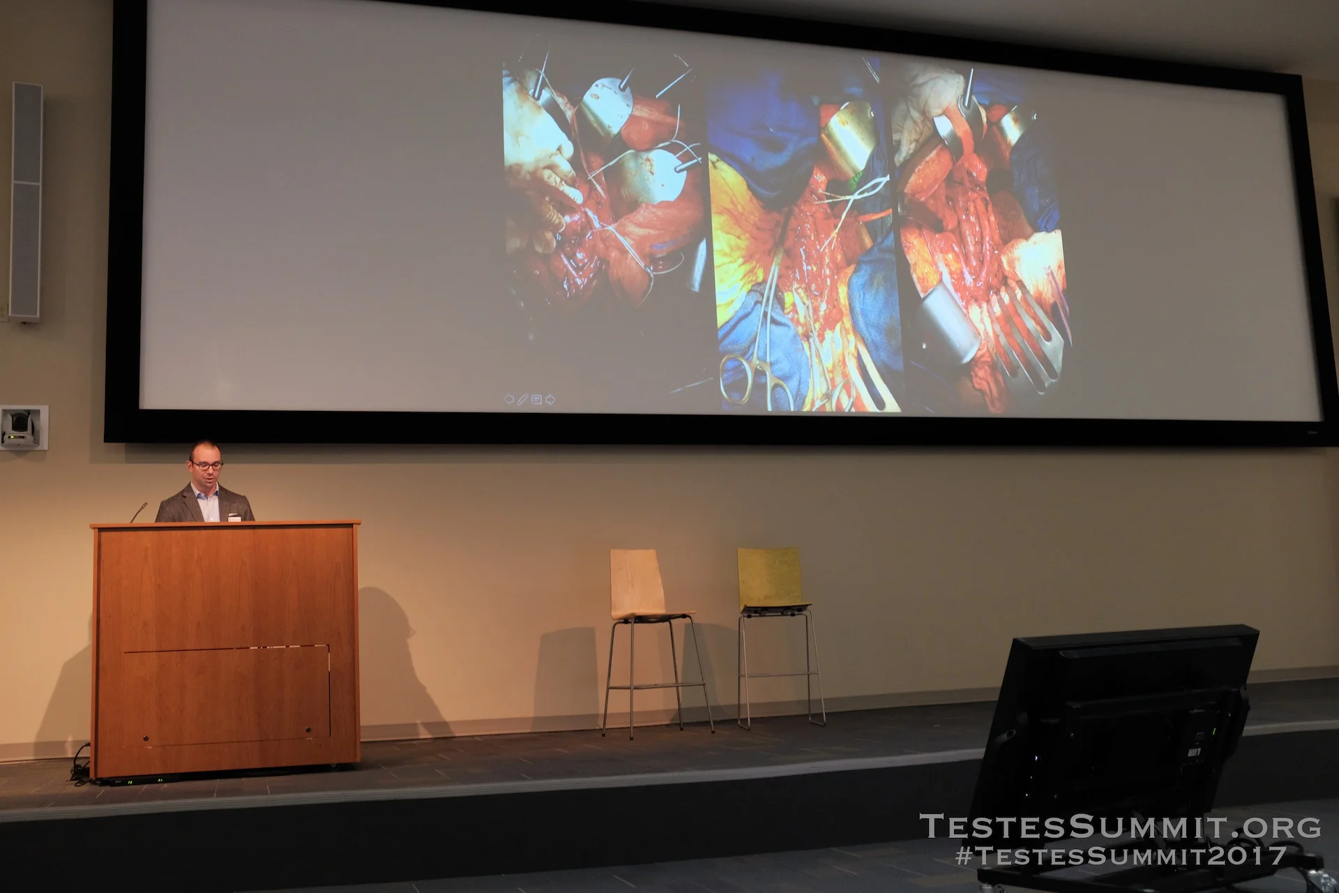 TestesSummit2017-PIERORAZIO_029_DSCF5563ap-HD-WM.jpg