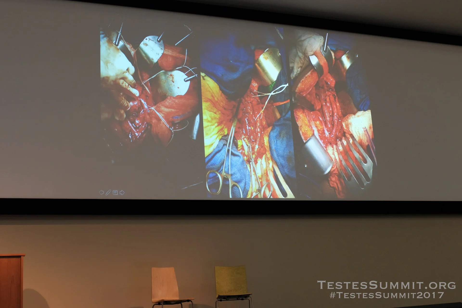 TestesSummit2017-PIERORAZIO_030_DSCF5564ap-HD-WM.jpg