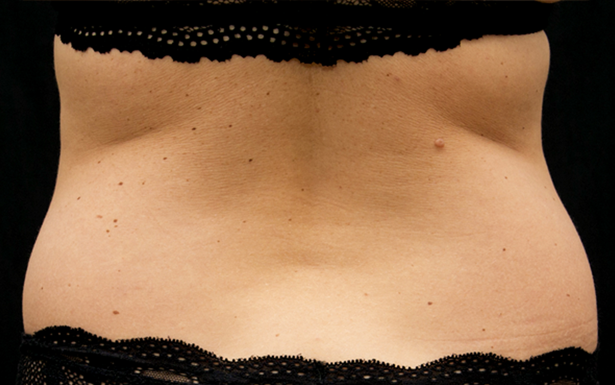 women-absFlanks