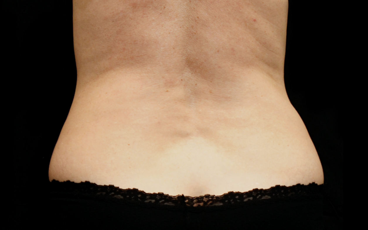 women-absFlanks