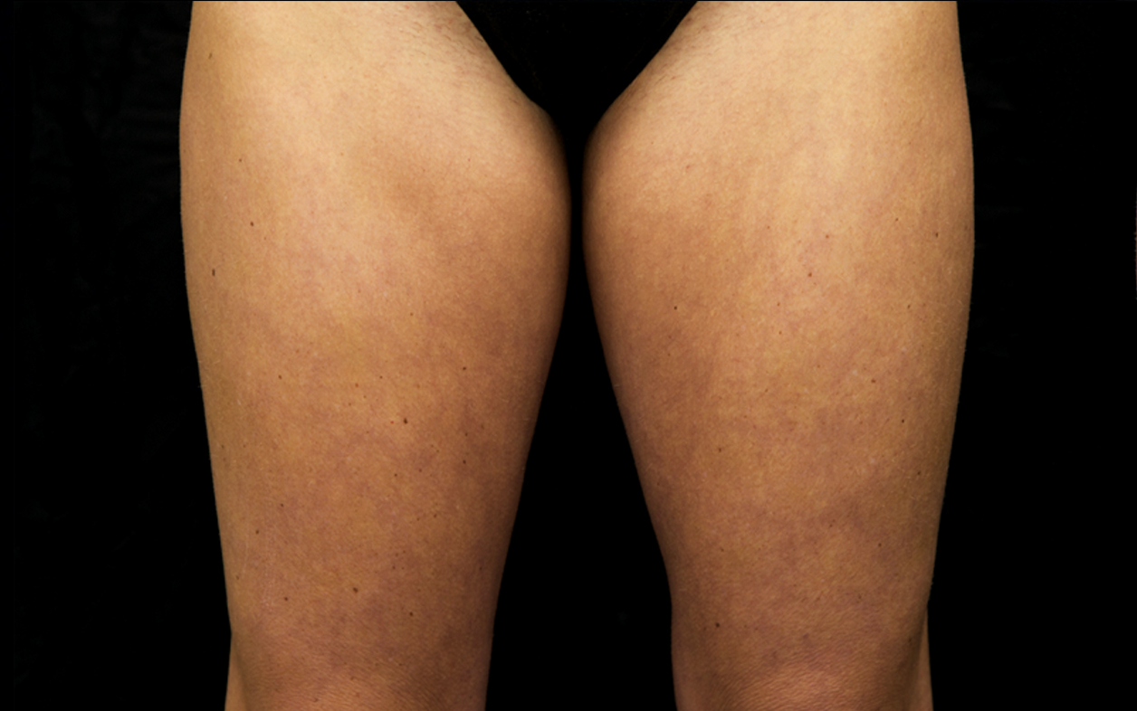Women-Thighs