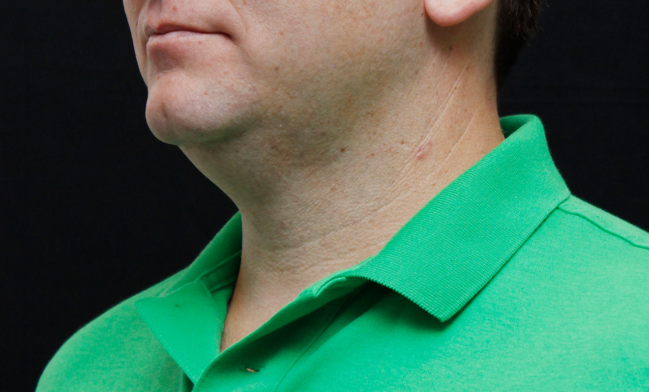 men-chin