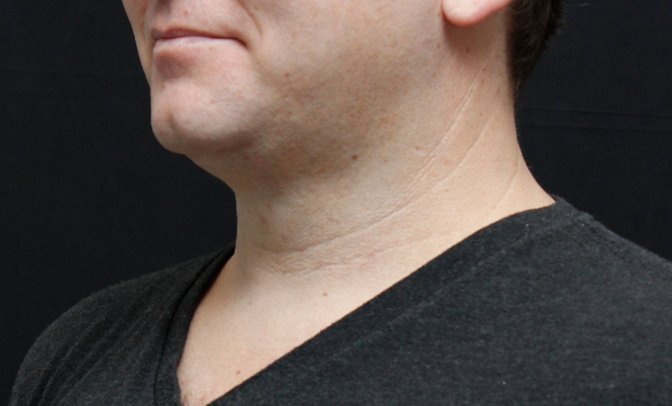 men-chin