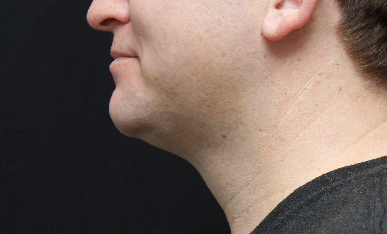 men-chin