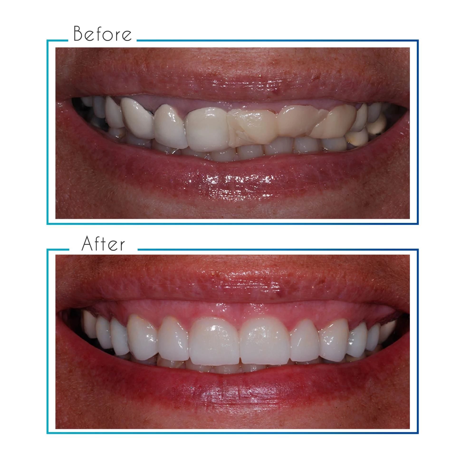 before- after-06.jpg