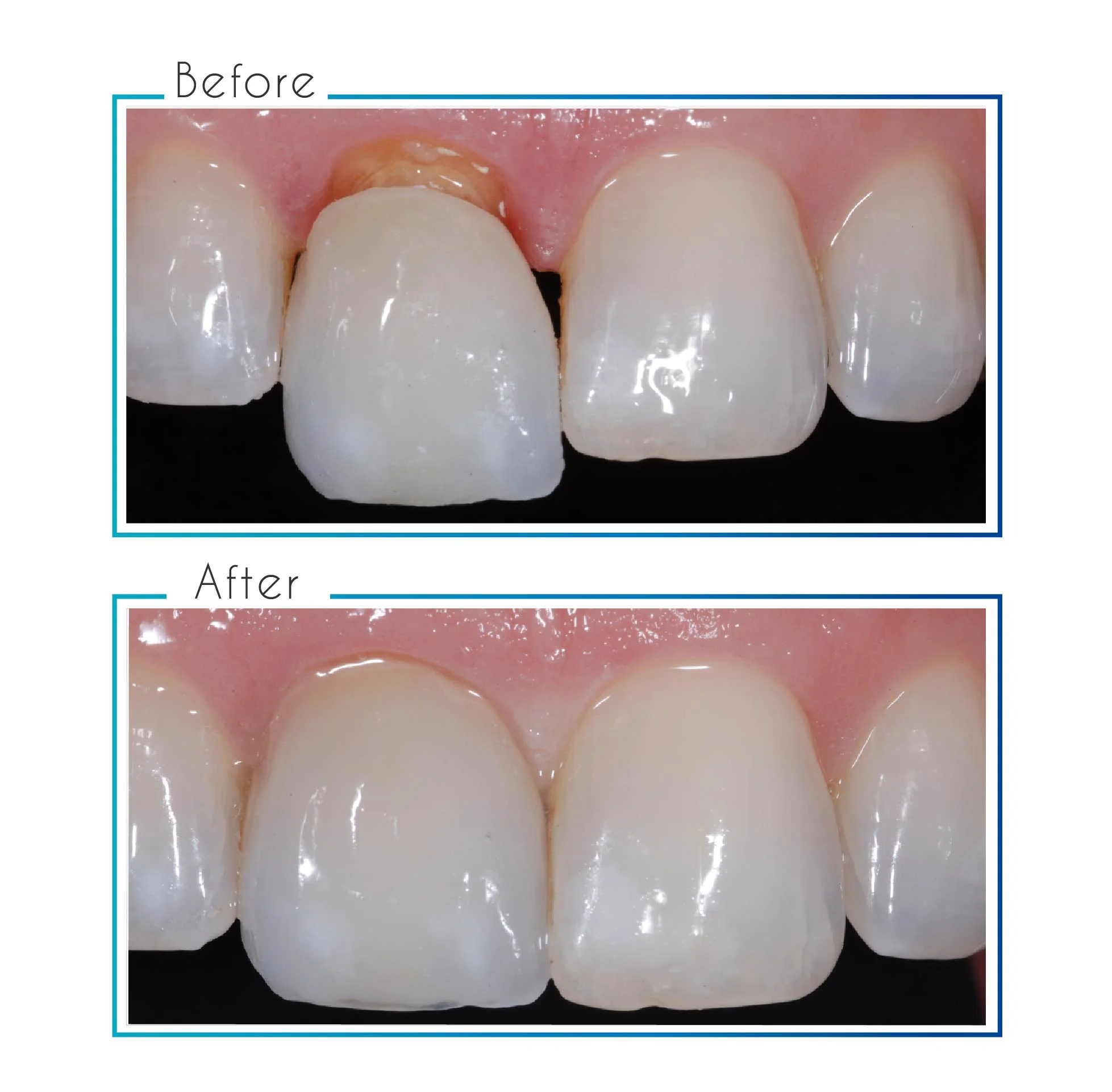 before- after-03.jpg
