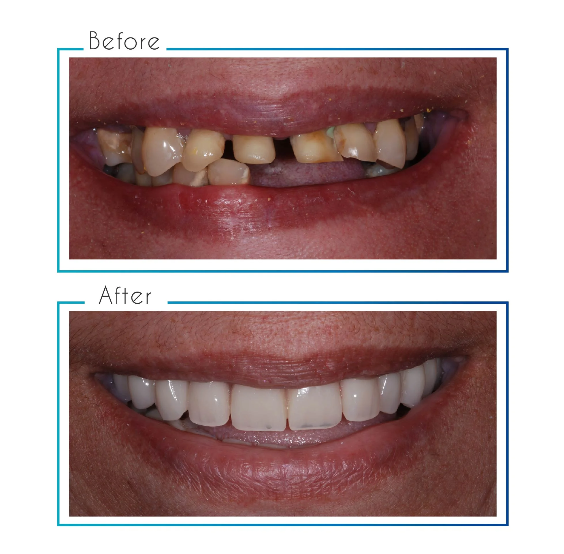 before- after-14.jpg
