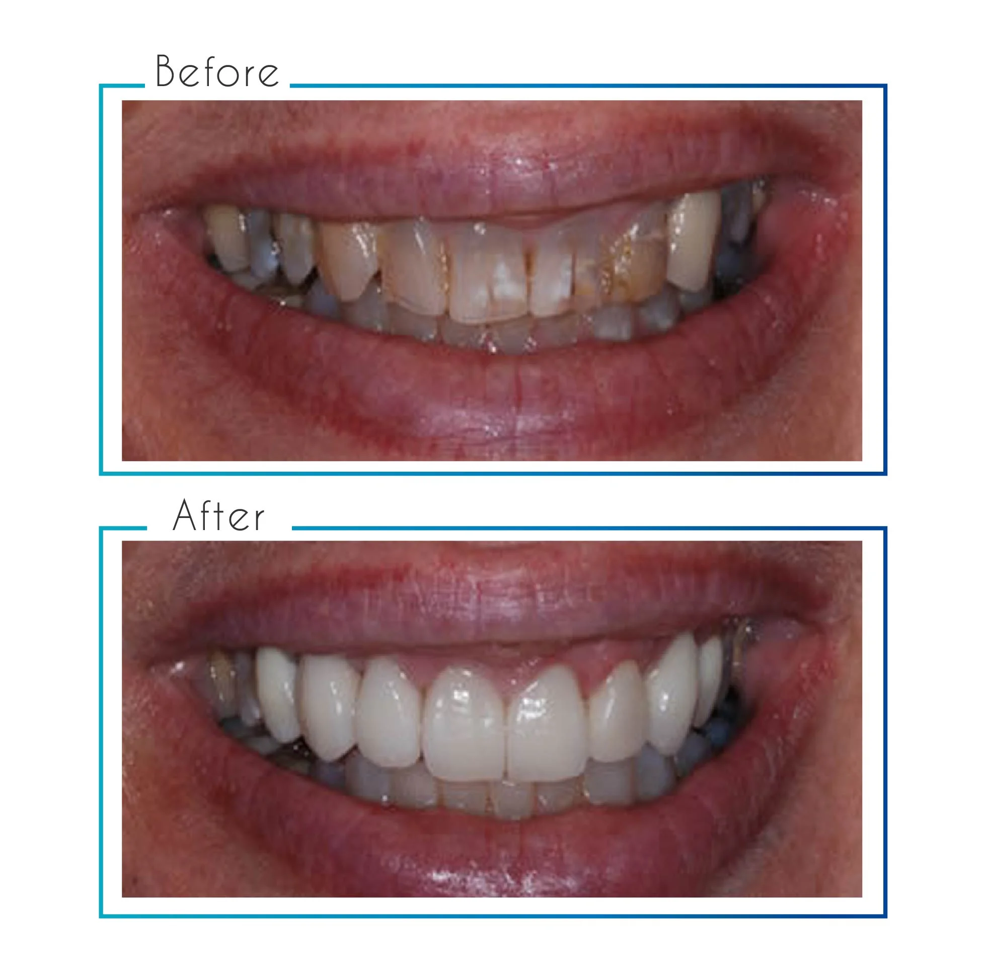 before- after-12.jpg