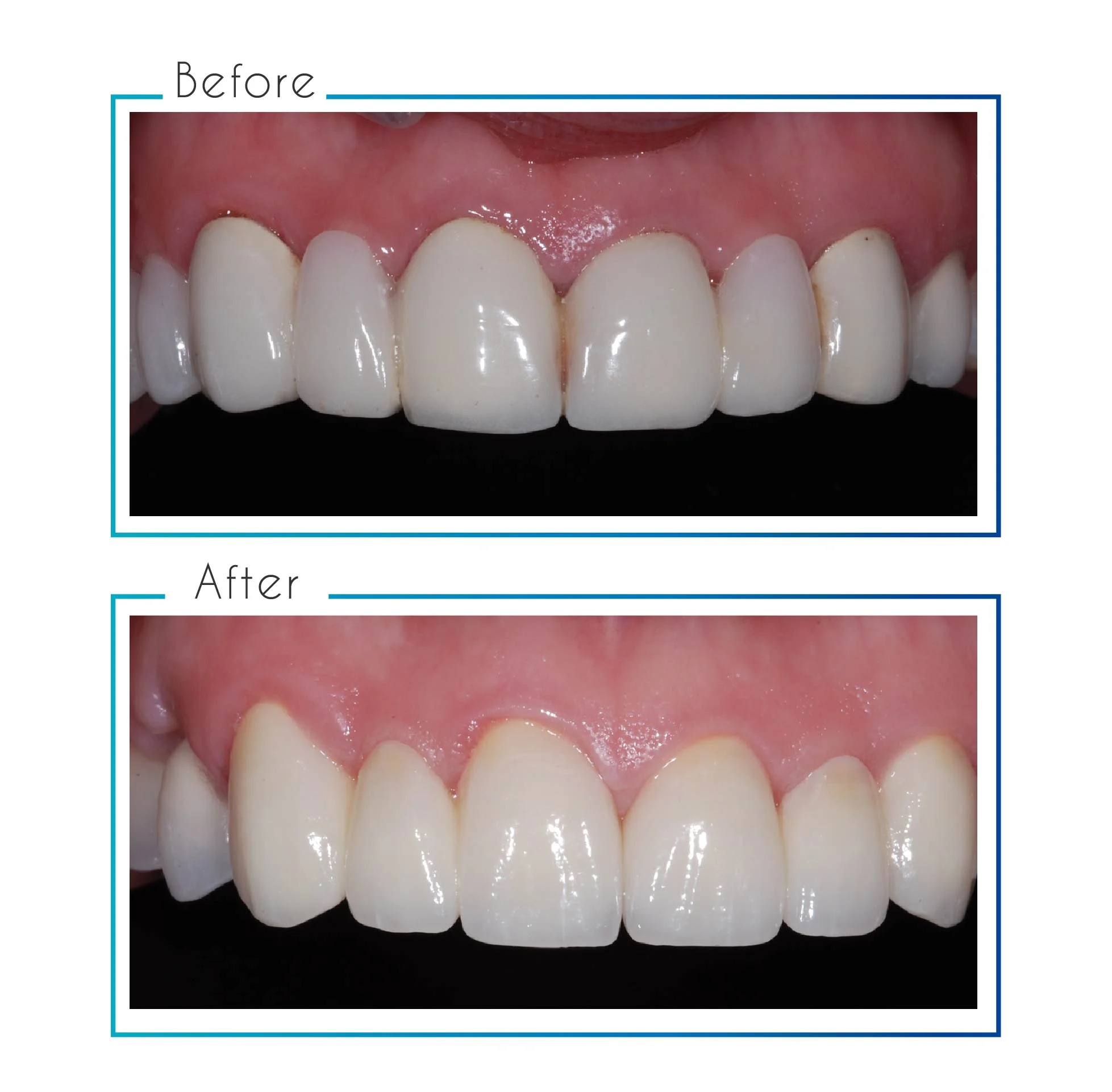 before- after-10.jpg