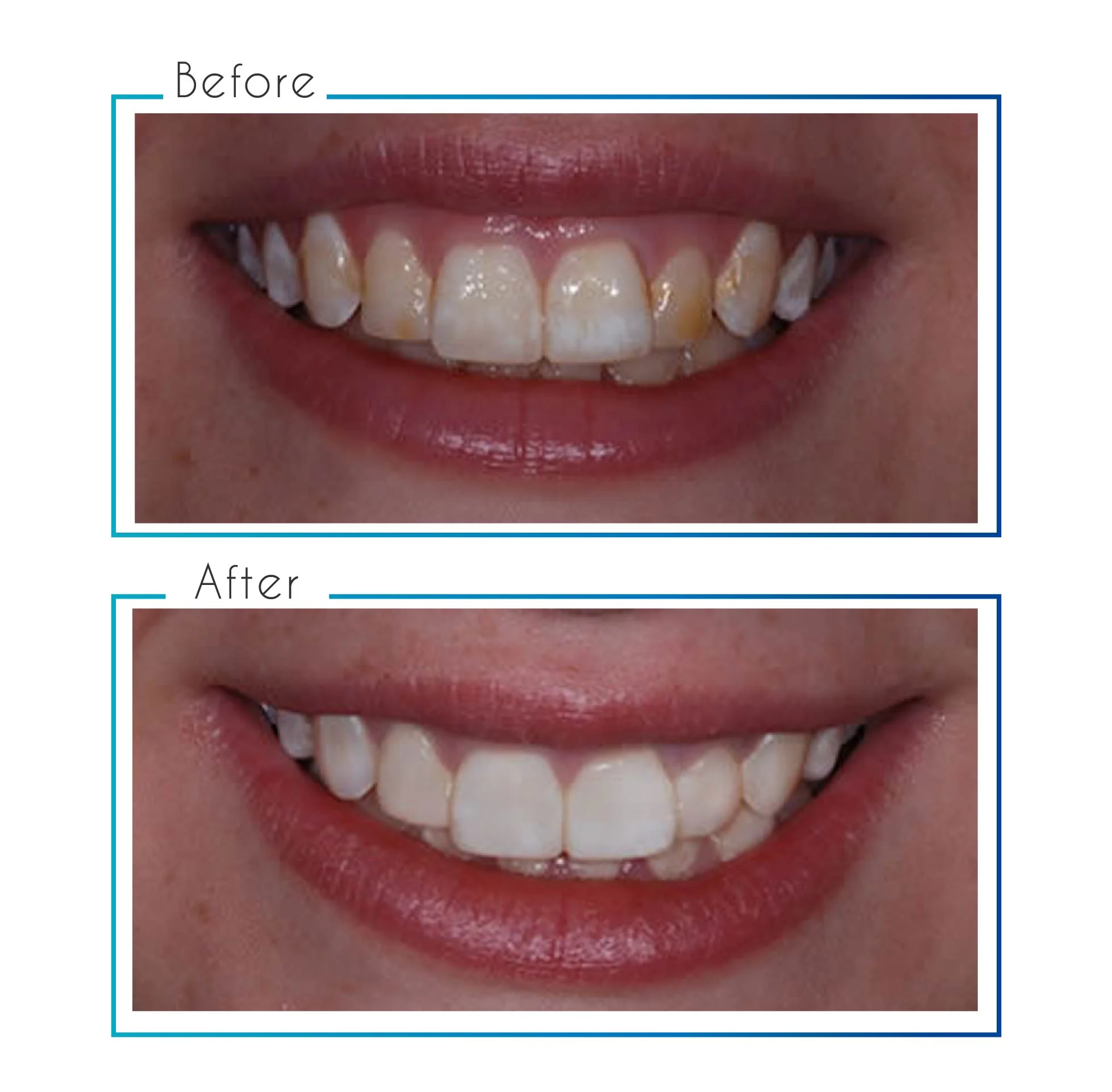 before- after-11.jpg