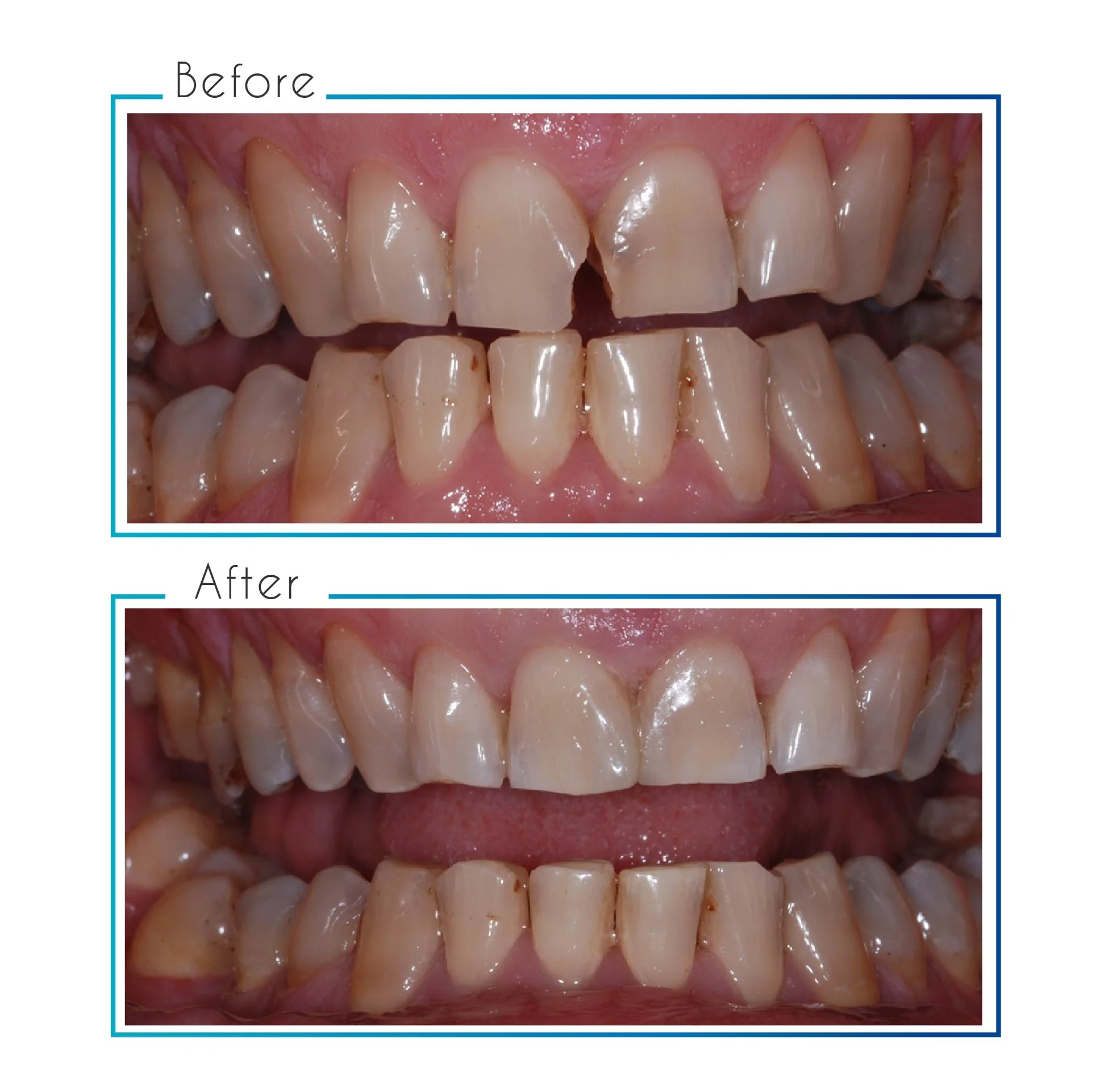 before- after-05.jpg