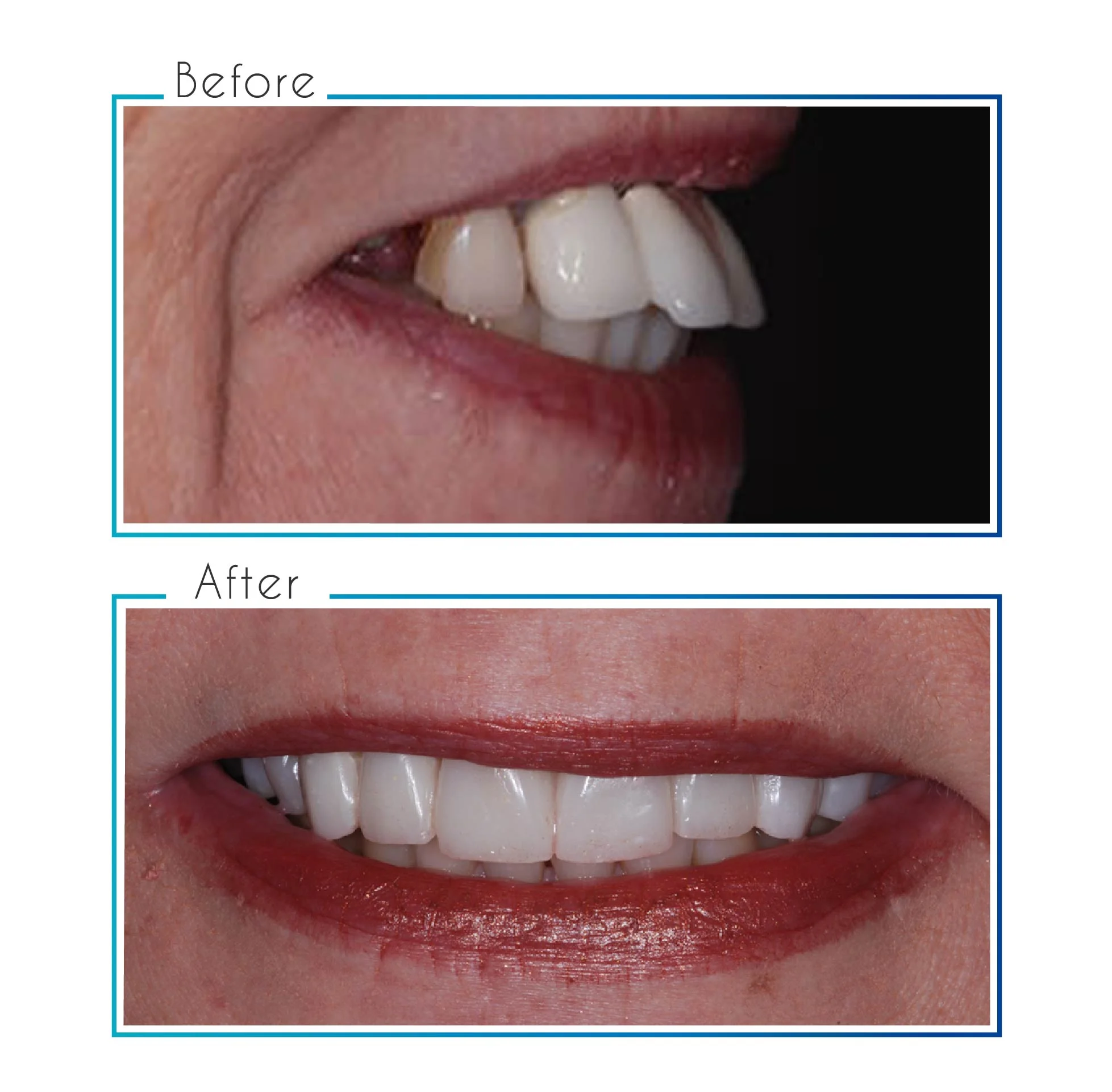 before- after-02.jpg