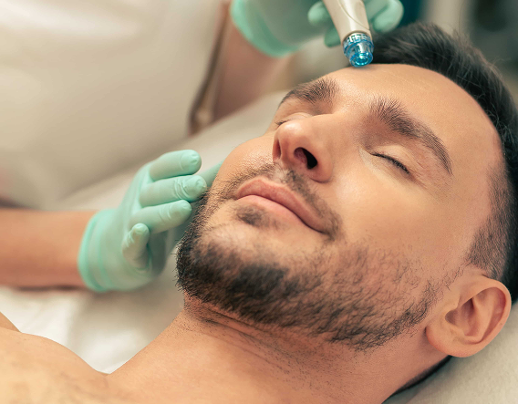 A male client is undergoing microdermabrasion treatment with a handheld device for skin resurfacing and exfoliation.