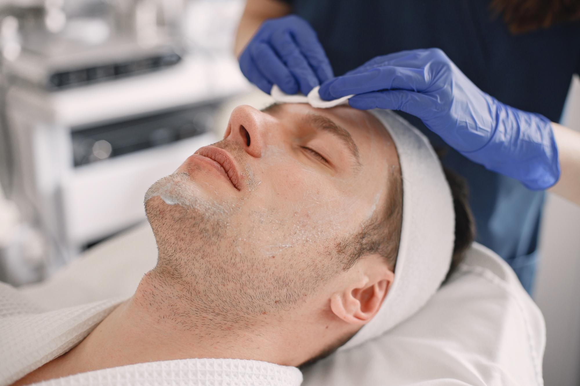 Chemical Peel for Men: Benefits, Risks, Cost & Everything You Should Know