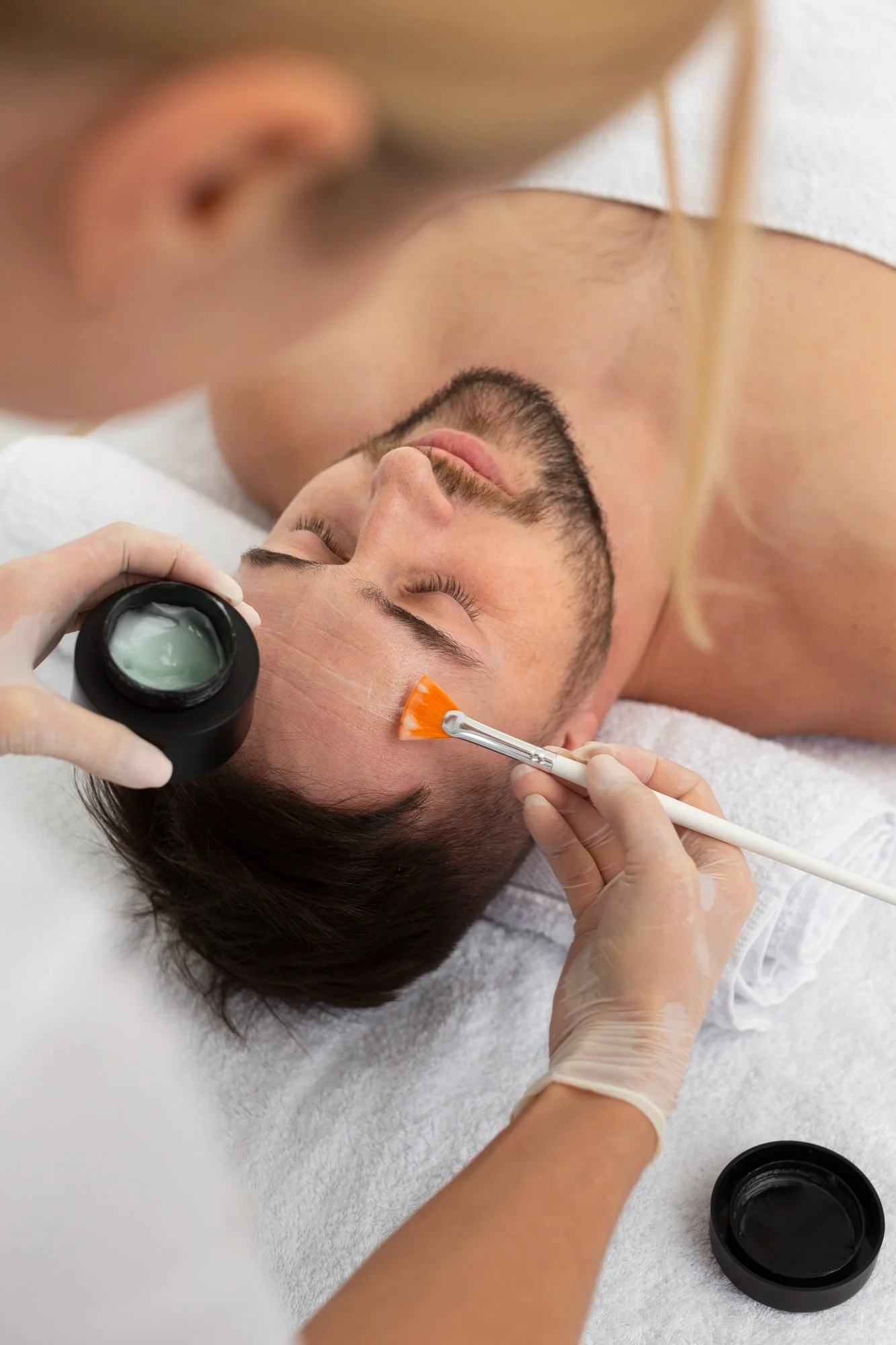 Chemical Peel With a Beard: A Complete Guide for Men