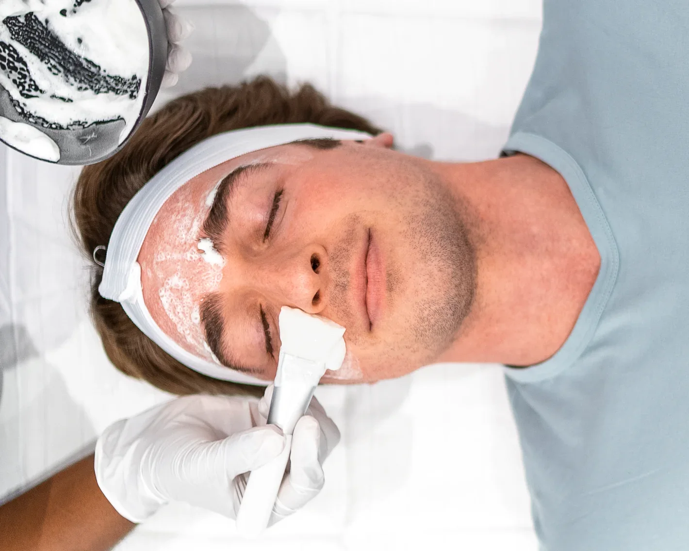 Esthetician applying skin peel to a man's face using a brush during an in-office chemical peel treatment.