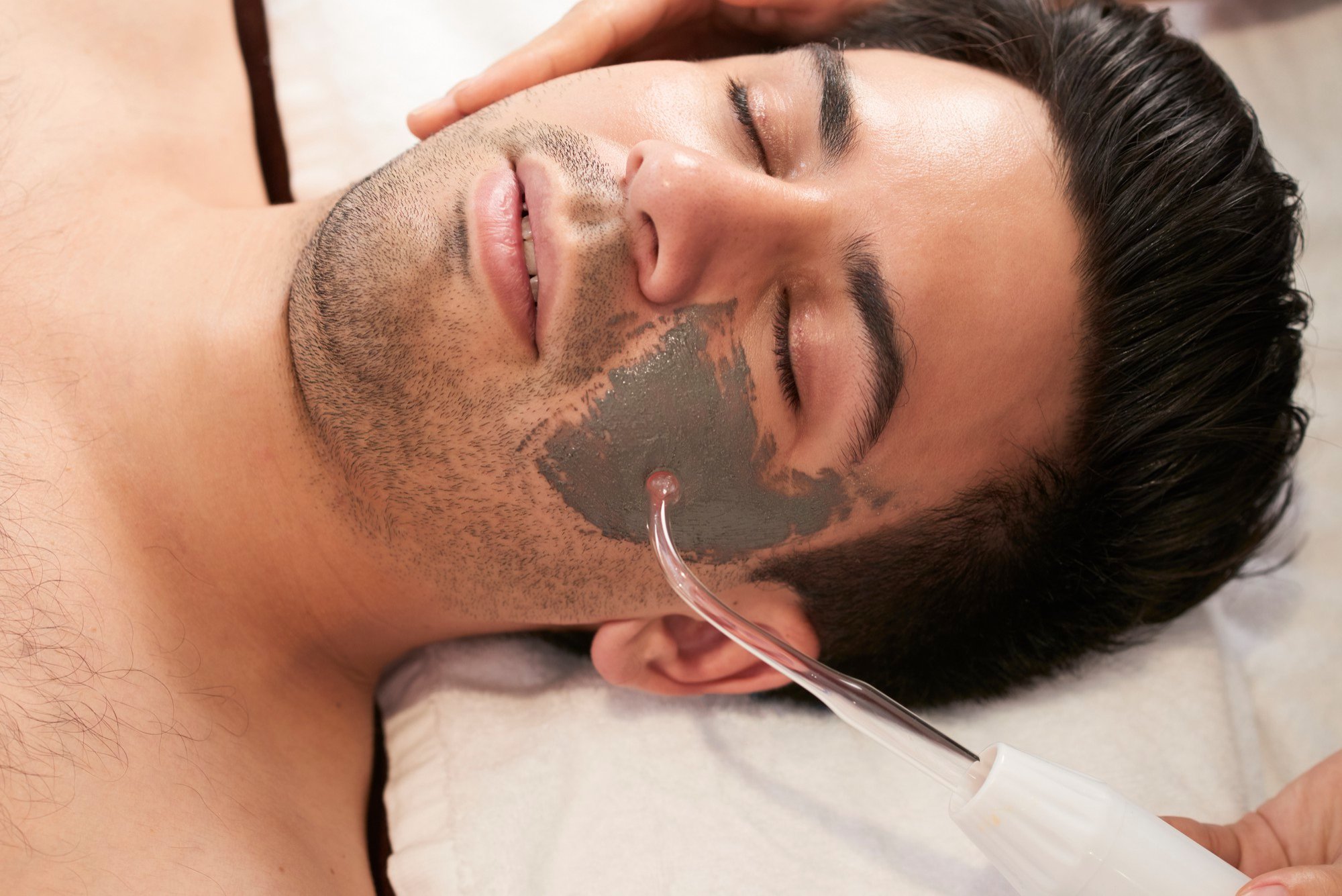 Client is undergoing a darker resurfacing mask representing a medium chemical peel targeting deeper texture concerns.