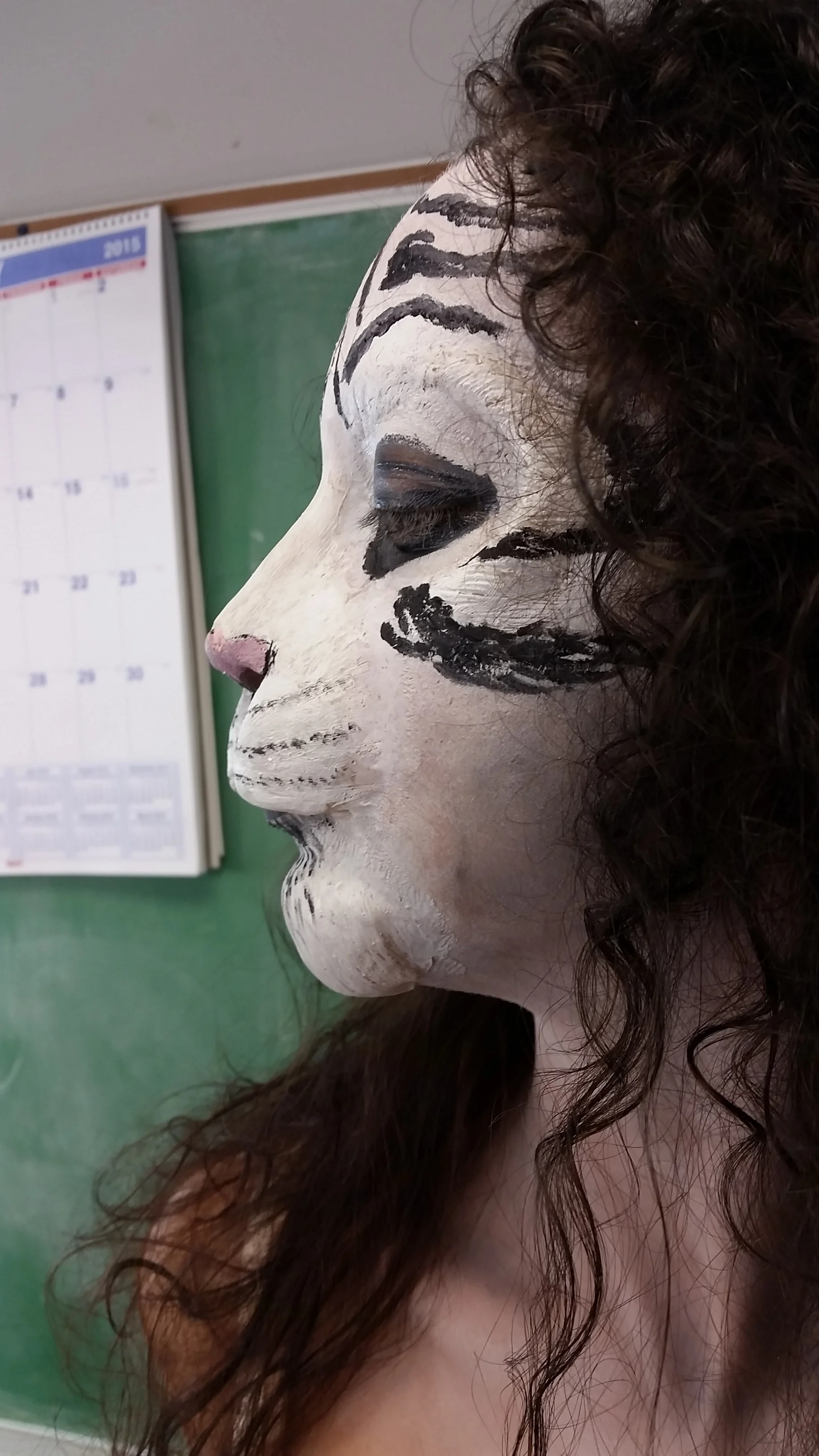 profile view of prosthetic application