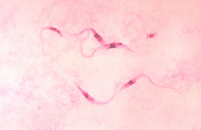 Trypanosoma cruzi crithidia by Photo Credit:Content Providers(s): CDC/Dr. Myron G. Schultz - This media comes from the Centers for Disease Control and Prevention's Public Health Image Library (PHIL), with identification number #613.Note: Not all PHIL images are public domain; be sure to check copyright status and credit authors and content providers.English | Slovenščina | +/−. Licensed under Public Domain via Commons - https://commons.wikimedia.org/wiki/File:Trypanosoma_cruzi_crithidia.jpeg#/media/File:Trypanosoma_cruzi_crithidia.jpeg