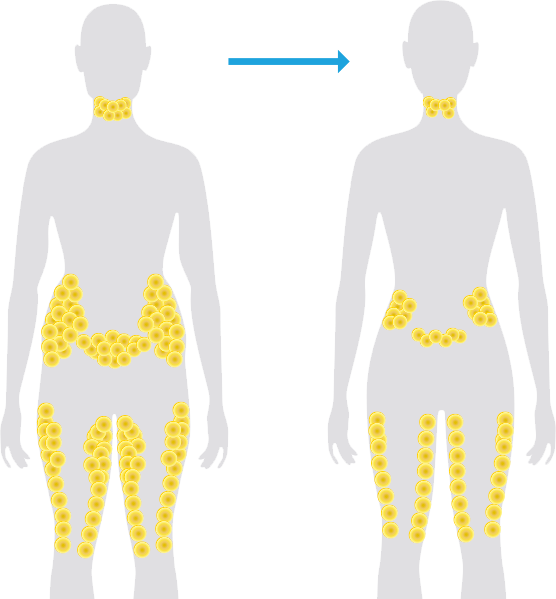 coolsculpting-fat-reduction.png
