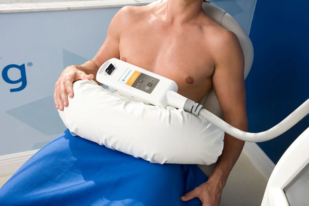 Coolsculpting for men in San Antonio