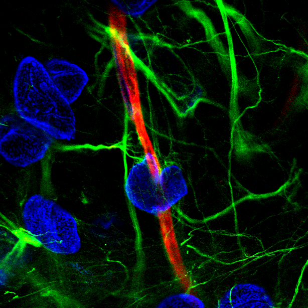 Astrocyte.png