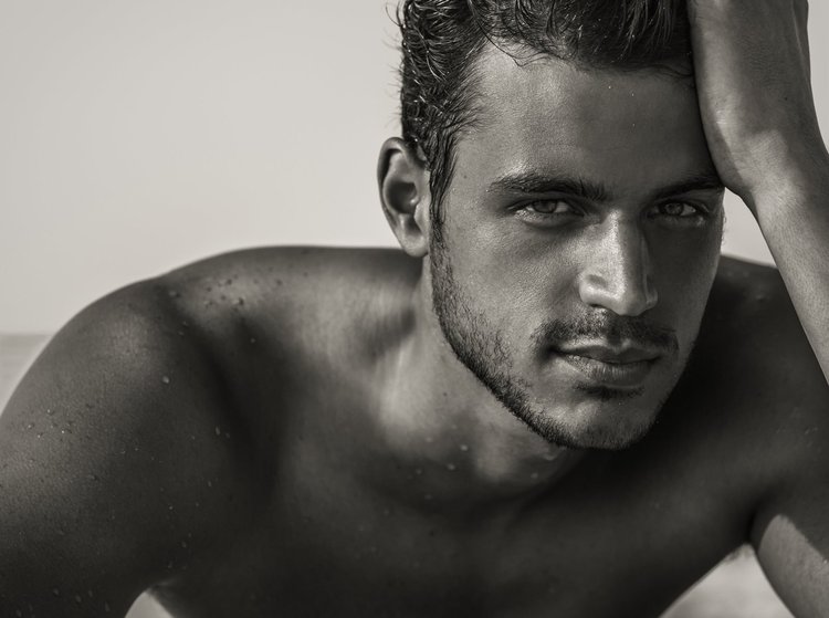 Man with smooth, matte skin and refined pores after a GlowTox micro-Botox facial in San Diego