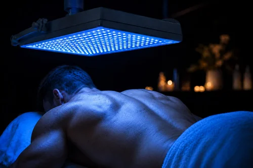 Back acne treatment in San Diego