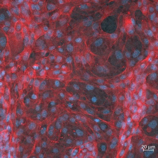 How Do Probiotics Work? Moving from Microbiome Associations to Mechanism Exploration with Vagina-on-a-Chip Technology