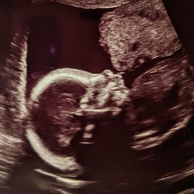 We're having a baby! Due end of May 2020! 💛