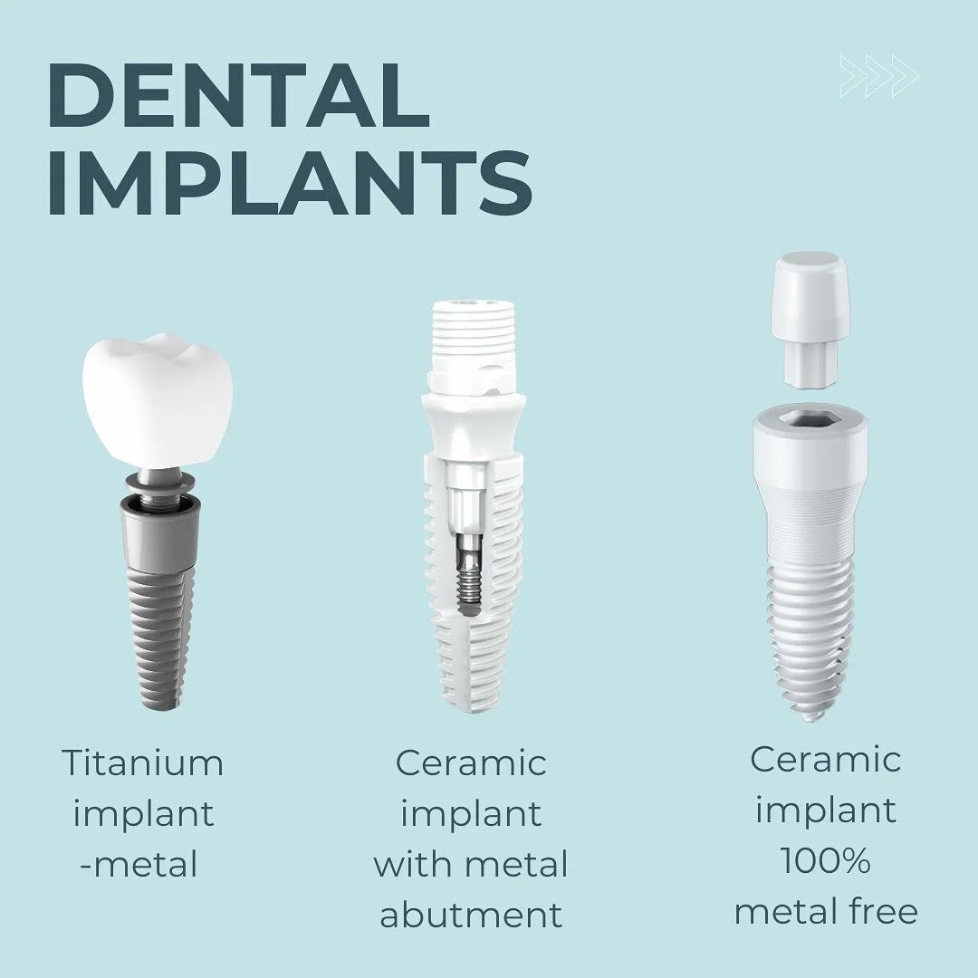 The world of dental implants has been dominated by titanium implants and it is still dominated. 
A small group of people especially one pioneer the late prof Sami Sandhaus has developed the first metal free implants. 
It was always in the minds to de