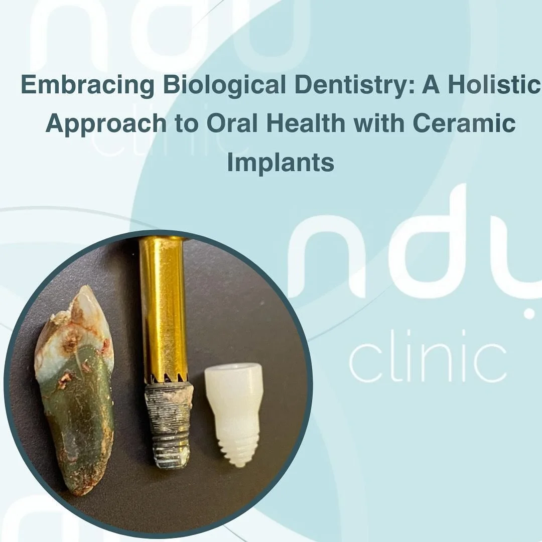 Dental implants have long been a transformative solution for individuals seeking to replace missing teeth and restore oral functionality. Among the diverse materials used for dental implants, ceramic has emerged as a cutting-edge alternative, offerin