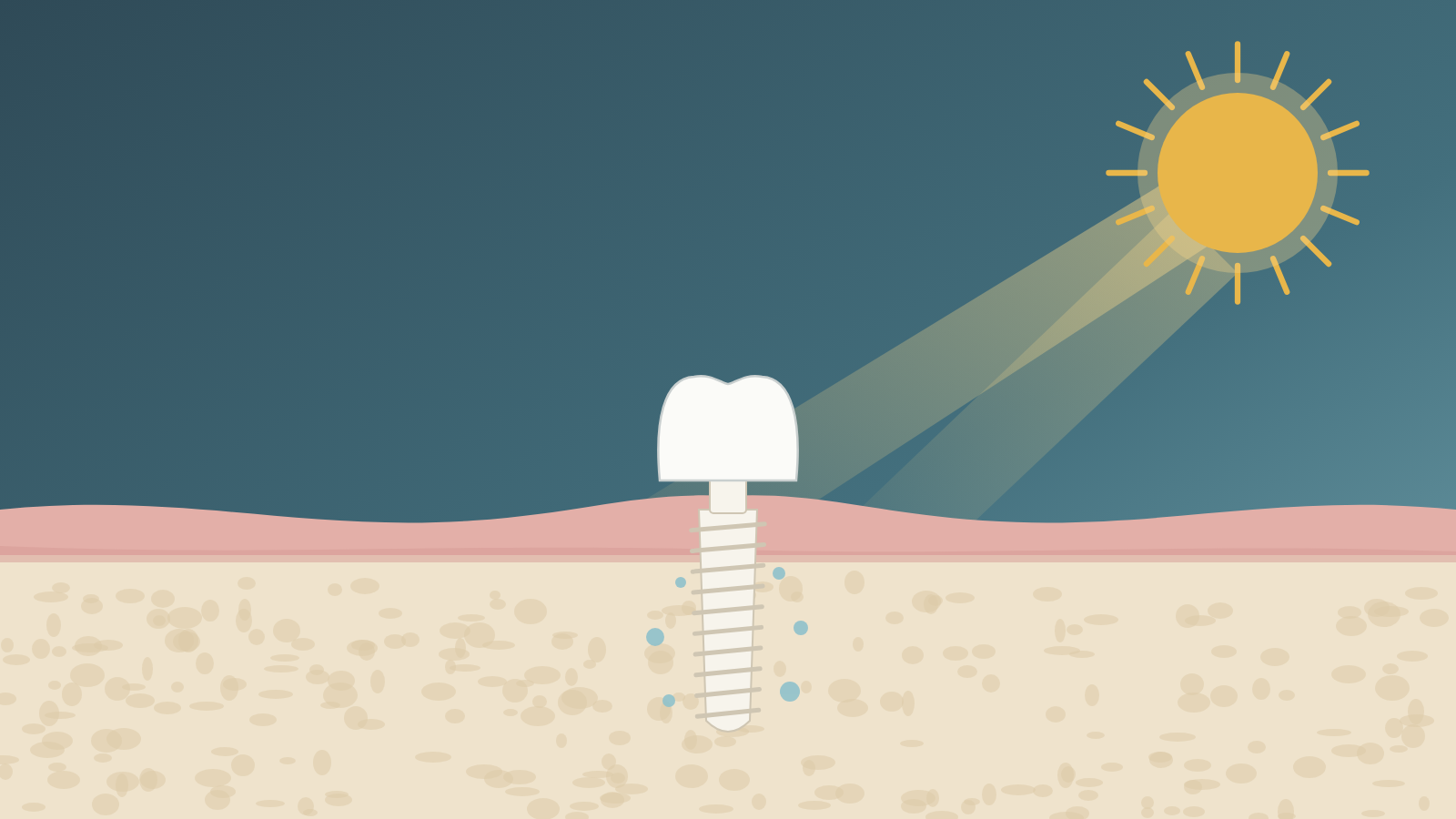 Vitamin D and Dental Implants: Preparing the Body to Heal