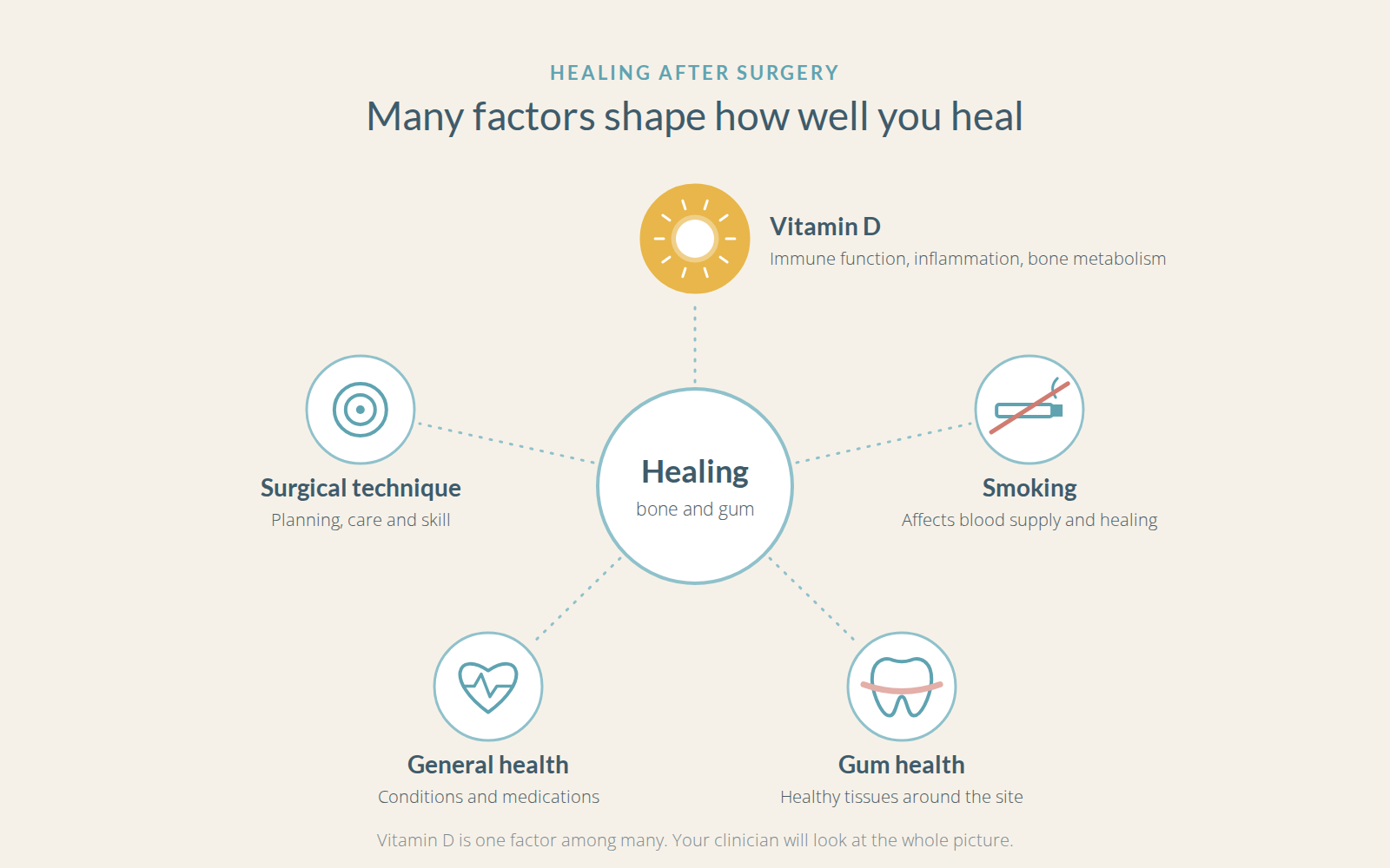 Vitamin D shown alongside smoking, gum health, general health and surgical technique as factors in healing