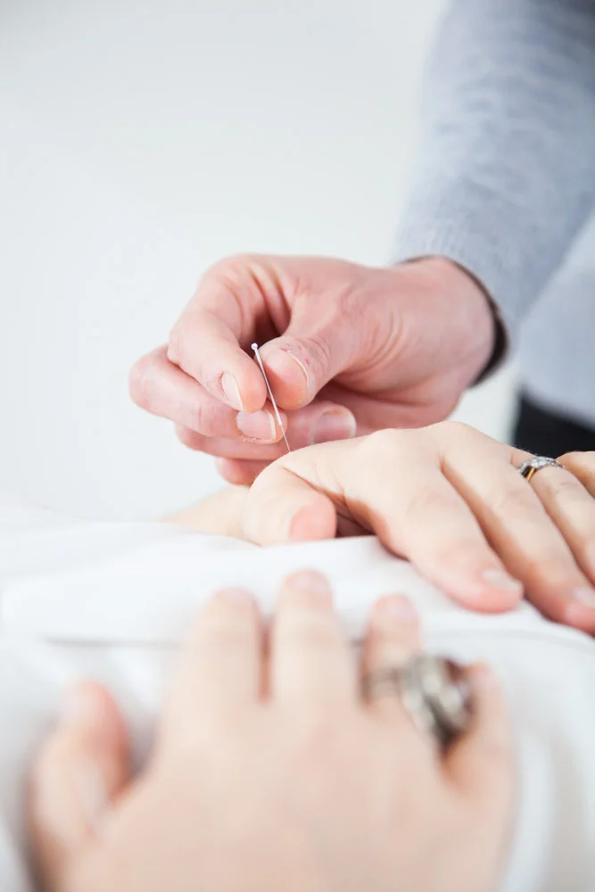 Treatment and Fees — SILVERWOOD ACUPUNCTURE