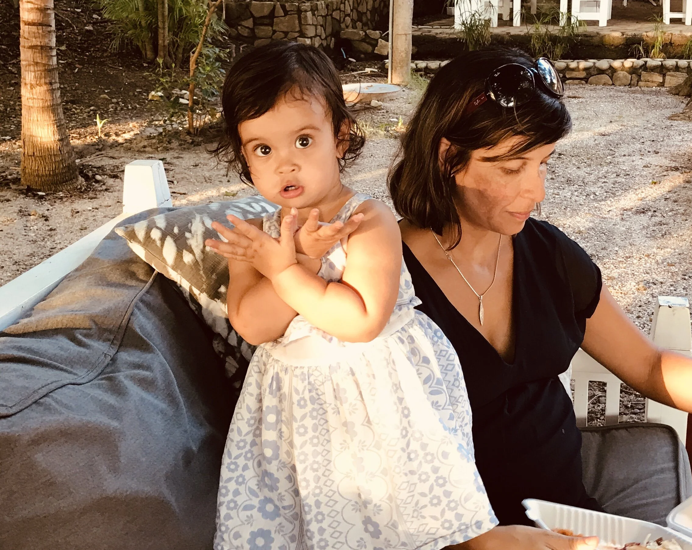 Melasma: not just a skin condition of pregnancy